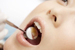 歯科医院での検査方法