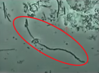 位相差顕微鏡で見るカンジダ菌