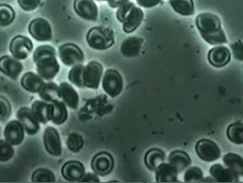 位相差顕微鏡で見る赤血球