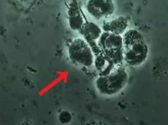 位相差顕微鏡で見る白血球