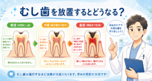 むし歯を放置するとどうなる？症状の変化と歯科医師が教える対処法