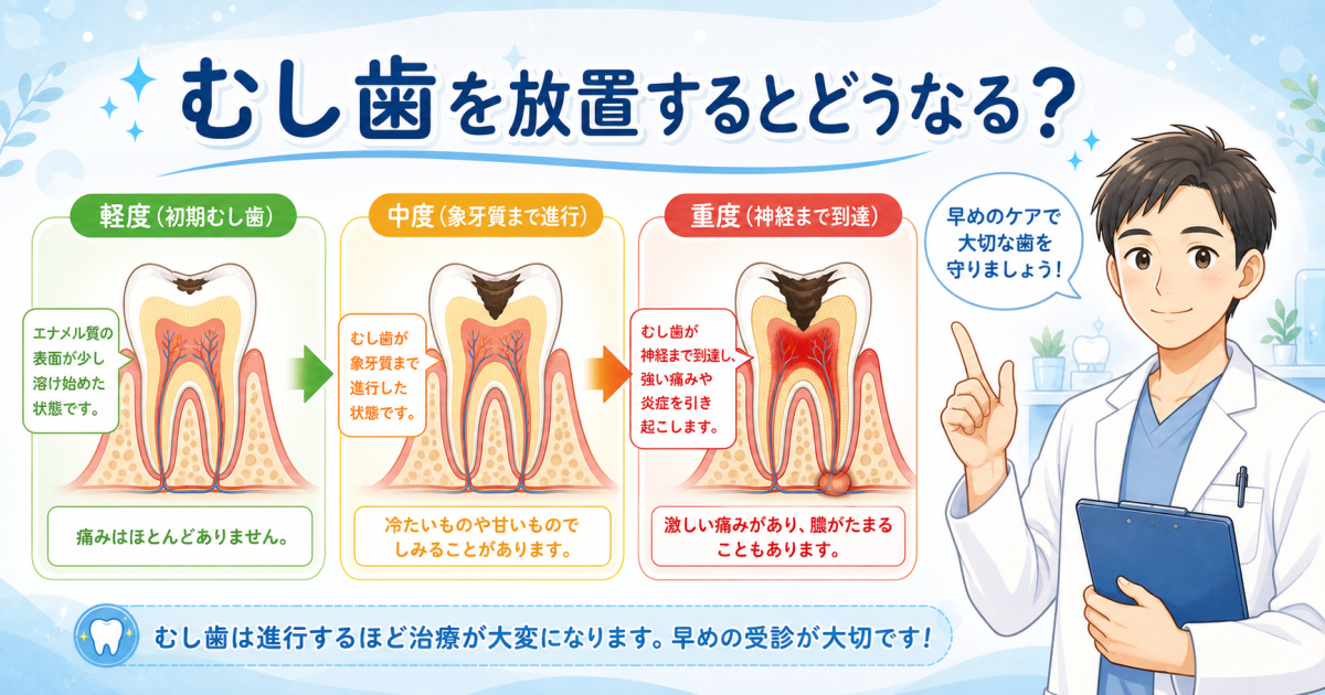 むし歯を放置するとどうなる？症状の変化と歯科医師が教える対処法