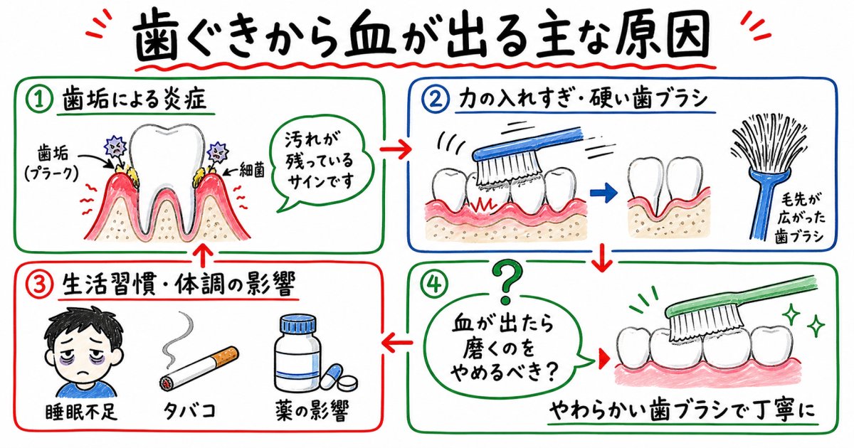 歯磨きで歯ぐきから血が出る主な原因とメカニズム